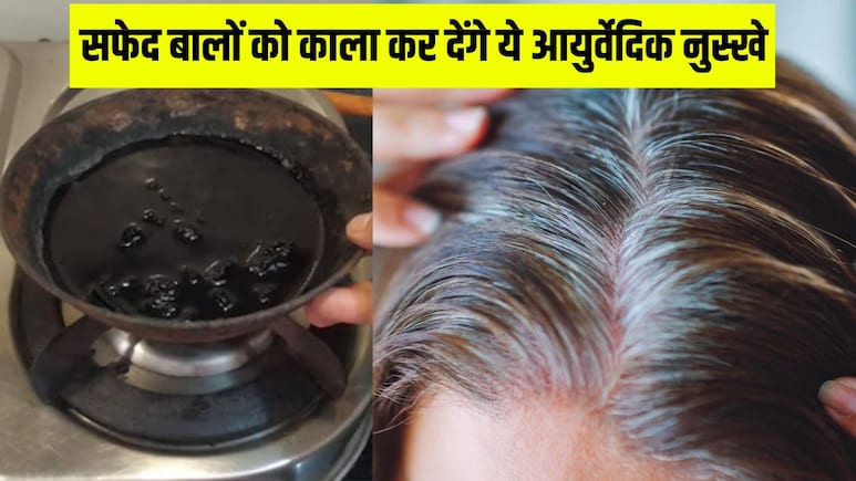 30 दिन तक आजमा लें ये 3 नुस्खे, आयुर्वेदिक डॉक्टर ने बताया सारे सफेद बाल हो जाएंगे काले