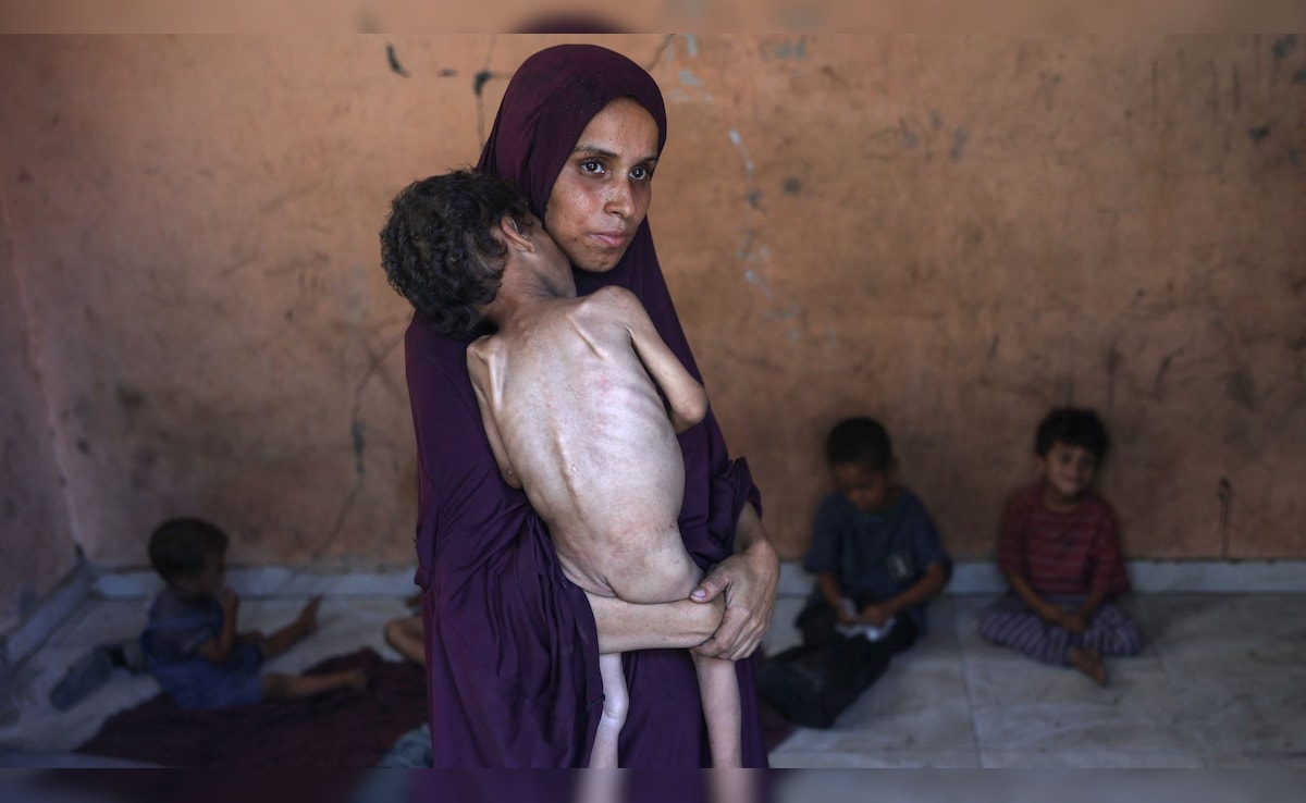 30 वर्षीय फिलिस्तीनी मां अपने कुपोषित 2 वर्षीय बेटे को गोद में लिए हुए (AFP)