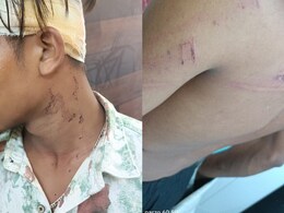 Rajasthan: हॉस्टल में सीनियर छात्रों ने की जूनियर्स की रैगिंग, मारपीट में 3 स्टूडेंट्स घायल; घटना के वक्त वार्डन था नदारद