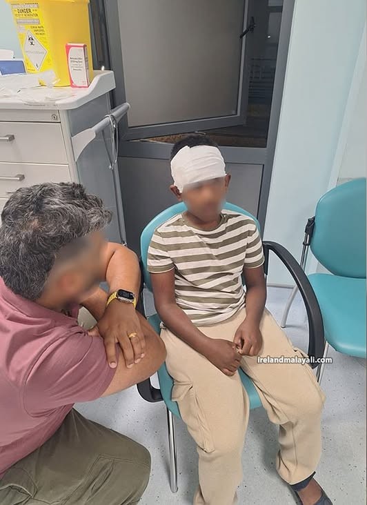 9-Year-Old Boy Stoned By Teen In Ireland, Family Calls It Racial Attack
