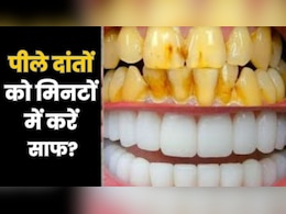 पीले दांतों को मोतियों सा चमकाने के घरेलू नुस्खे, चौथा नुस्खा है सबसे असरदार पीले दांतों को मोतियों सा चमकाने के घरेलू नुस्खे, चौथा नुस्खा है सबसे असरदार