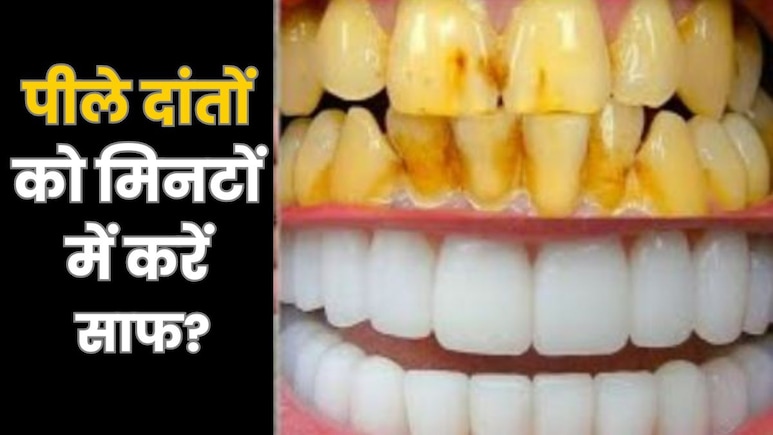 पीले दांतों को मोतियों सा चमकाने के घरेलू नुस्खे, चौथा नुस्खा है सबसे असरदार पीले दांतों को मोतियों सा चमकाने के घरेलू नुस्खे, चौथा नुस्खा है सबसे असरदार