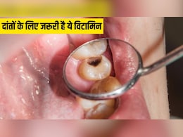 किस विटामिन की कमी से दांतों में लगता है कीड़ा? किस विटामिन की कमी से दांतों में लगता है कीड़ा?