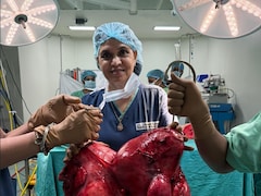 डॉक्टरों की टीम ने महिला के गर्भाशय से निकाला 18.5 KG का ट्यूमर, जानें लक्षण, कारण और इलाज