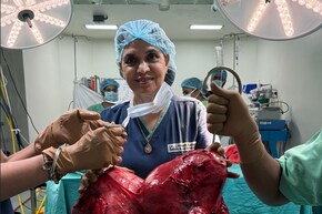 डॉक्टरों की टीम ने महिला के गर्भाशय से निकाला 18.5 KG का ट्यूमर, जानें लक्षण, कारण और इलाज