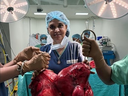 डॉक्टरों की टीम ने महिला के गर्भाशय से निकाला 18.5 KG का ट्यूमर, जानें लक्षण, कारण और इलाज डॉक्टरों की टीम ने महिला के गर्भाशय से निकाला 18.5 KG का ट्यूमर, जानें लक्षण, कारण और इलाज