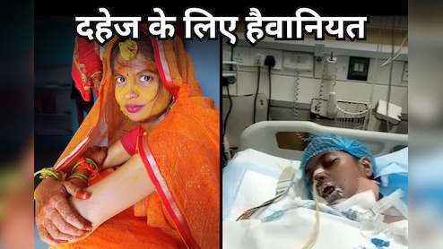 दहेज के लिए पहले गर्म चिमटे से दागा, मन नहीं माना तो कोल्ड ड्रिंक में मिलाया जहर, गंभीर हालत में दिल्ली रेफर