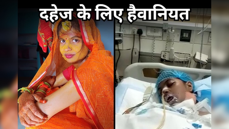दहेज के लिए पहले गर्म चिमटे से दागा, मन नहीं माना तो कोल्ड ड्रिंक में मिलाया जहर, गंभीर हालत में दिल्ली रेफर दहेज के लिए पहले गर्म चिमटे से दागा, मन नहीं माना तो कोल्ड ड्रिंक में मिलाया जहर, गंभीर हालत में दिल्ली रेफर