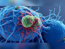 इम्यूनोथेरेपी की नई दवा ने तेजी से बढ़ने वाले कैंसर में दिखाए चौंकाने वाले नतीजे इम्यूनोथेरेपी की नई दवा ने तेजी से बढ़ने वाले कैंसर में दिखाए चौंकाने वाले नतीजे