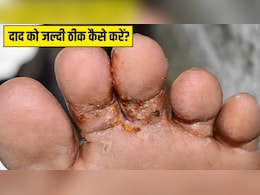 बारिश के पानी से पैरों में हो गया है दाद? आयुर्वेदिक डॉक्टर प्रताप चौहान ने बताया कैसे रोके फंगल इंफेक्शन, ज्यादा नहीं बढ़ेगी सड़न बारिश के पानी से पैरों में हो गया है दाद? आयुर्वेदिक डॉक्टर प्रताप चौहान ने बताया कैसे रोके फंगल इंफेक्शन, ज्यादा नहीं बढ़ेगी सड़न
