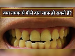 क्या नमक के पानी से पीले दांत साफ हो सकते हैं? क्या नमक के पानी से पीले दांत साफ हो सकते हैं?