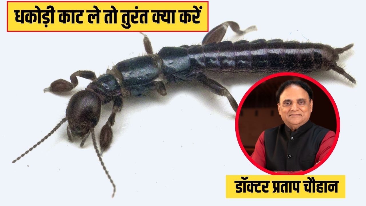 इस कीड़े के काटने पर होता है हार्ट अटैक जैसा दर्द, आयुर्वेदिक डॉक्टर से जानें धकोड़ी काट ले तो तुरंत क्या करें
