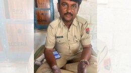 जैसलमेर के पुलिस कांस्टेबल के साहस की हो रही चर्चा... तेजाब से झुलसे हाथ और वर्दी, सुसाइड कर रहे युवक की बचाई जान