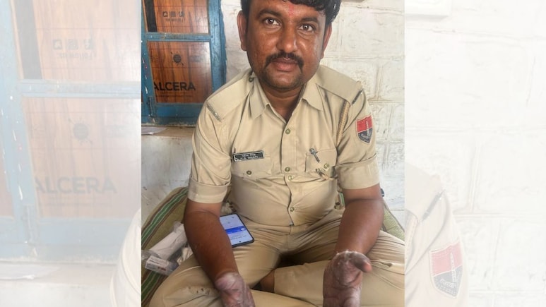 जैसलमेर के पुलिस कांस्टेबल के साहस की हो रही चर्चा... तेजाब से झुलसे हाथ और वर्दी, सुसाइड कर रहे युवक की बचाई जान