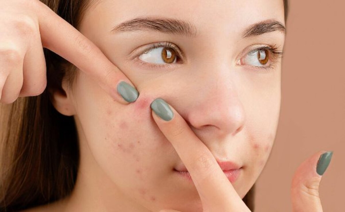 Popping Pimples in 'Triangle of Death': A Risky Move