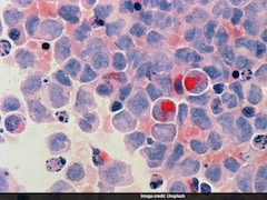 From Diet To Vaccine: Doctor Discusses 6 Ways To Prevent Majority Of Cancers
