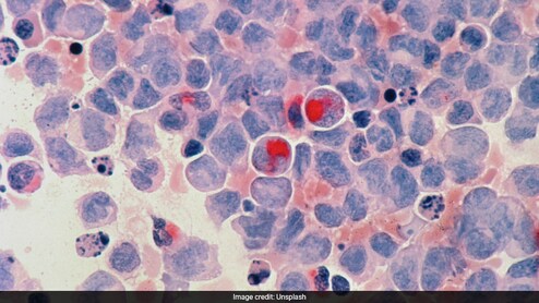 From Diet To Vaccine: Doctor Discusses 6 Ways To Prevent Majority Of Cancers