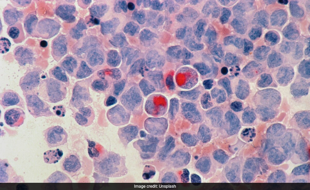 Доклад публикуван от Индийския журнал за медицински изследвания разкрива че