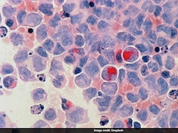 From Diet To Vaccine: Doctor Discusses 6 Ways To Prevent Majority Of Cancers From Diet To Vaccine: Doctor Discusses 6 Ways To Prevent Majority Of Cancers