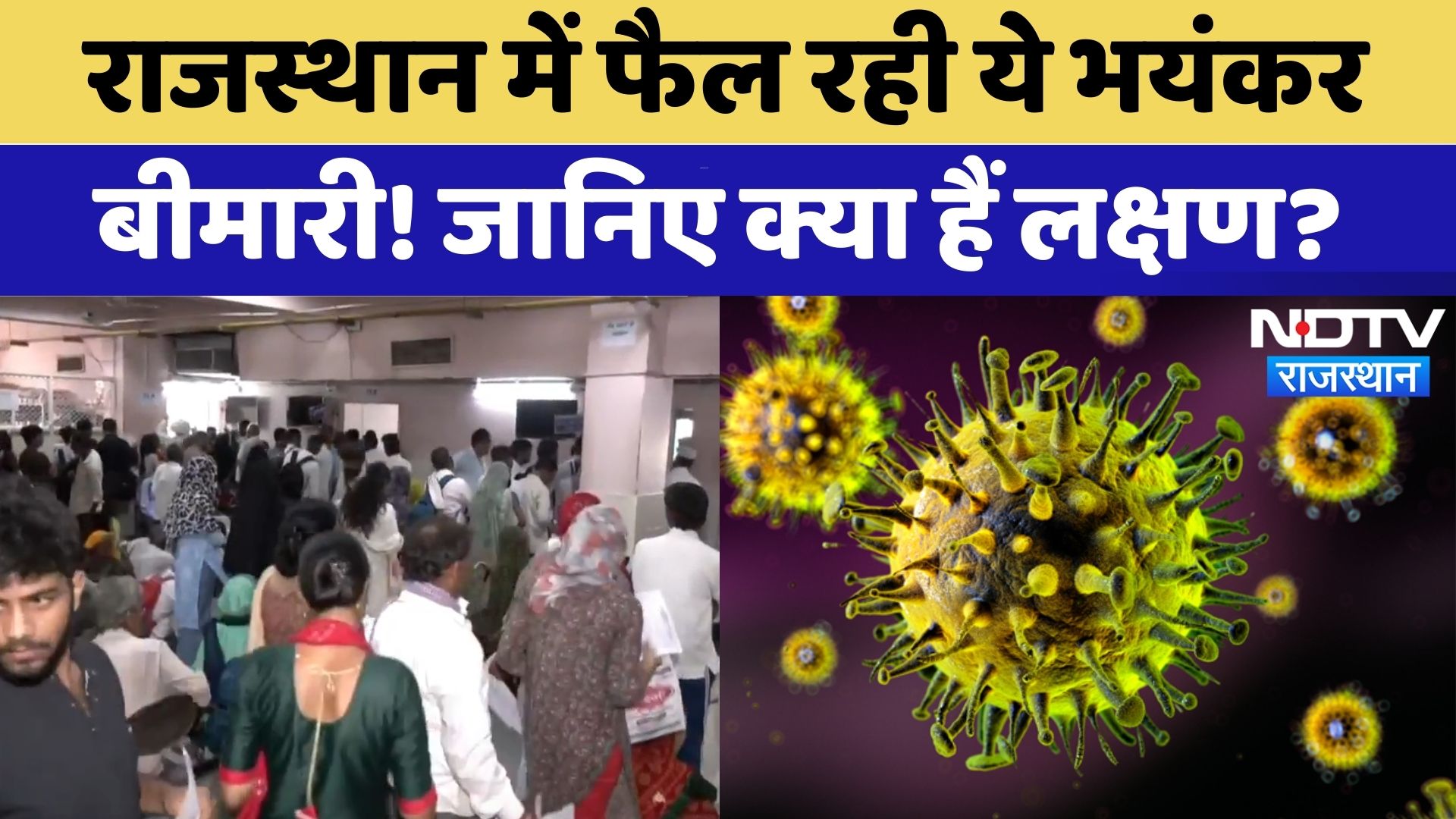 Scrub Typhus in Jaipur: राजस्थान बारिश का कहर, फैल रहीं मौसमी बीमारी | Rain | Monsoon | Rajasthan