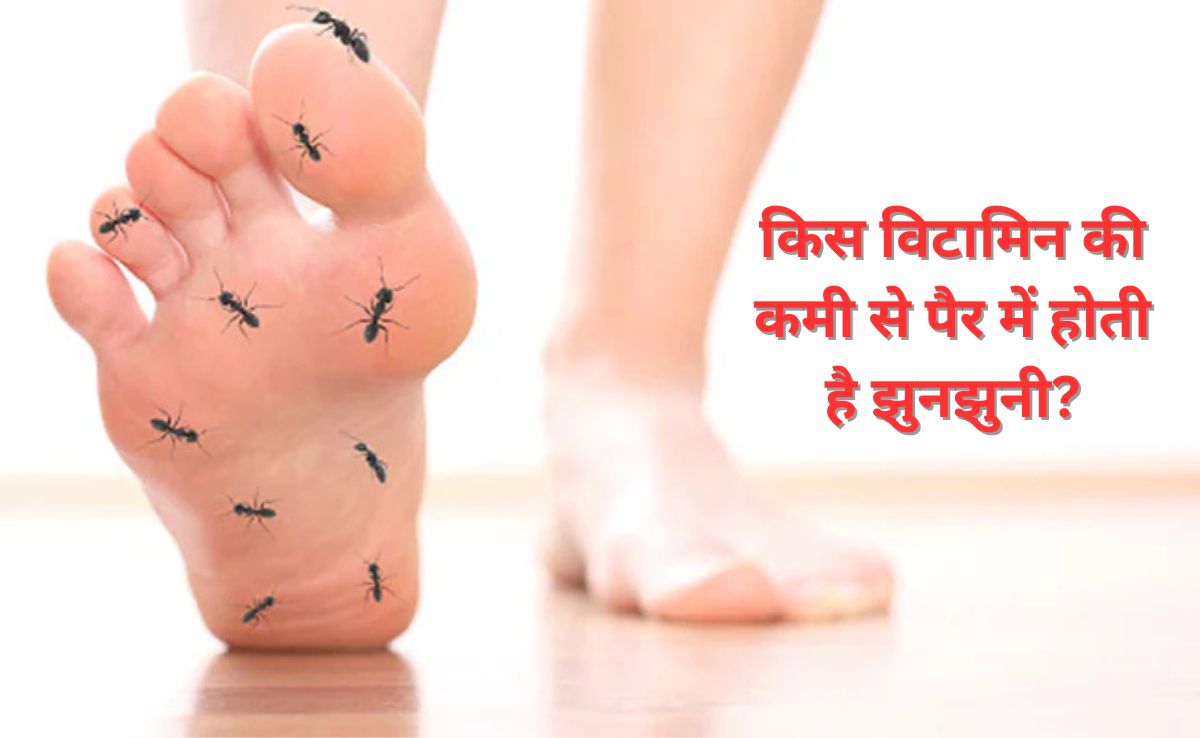 किस विटामिन की कमी से पैर में झुनझुनी होती है? जानिए यह चींटी चढ़ने की दिक्कत कैसे होगी दूर