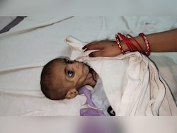 Malnutrition In Madhya Pradesh: Another Child Dead, Rehab Admissions Rise