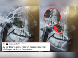 दांत के X-ray से खुली लड़की की चोरी, रिपोर्ट देखकर चौंके डॉक्टर दांत के X-ray से खुली लड़की की चोरी, रिपोर्ट देखकर चौंके डॉक्टर