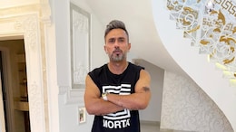 Honey Singh Opens Up About Hair Loss During Bipolar Disorder Treatment: What Really Causes It?