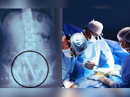 Akola News : विचित्र प्रकार! तरुणाच्या गुदद्वारात अडकला 2 फूट प्लास्टिकचा पाईप; ऑपरेशनवेळी झाली गंभीर अवस्था