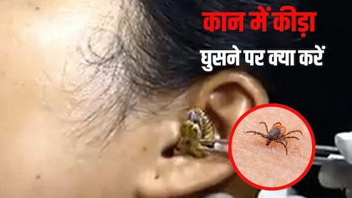 कान में अगर कोई कीड़ा घुस जाए तो क्या करें? क्या हम कीड़ों को दूर करने के लिए कान में पानी डाल सकते हैं