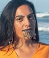 'Rs 6.5 Lakh Surgery In India': How This New Zealand Woman Lost 69 Kg