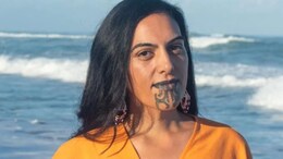 "Rs 6.5 Lakh, 2.5-Hour Weight Loss Surgery In India": How This New Zealand Woman Lost 69 Kg