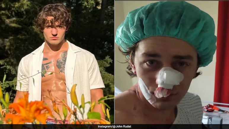 Heroic US Model Stabbed In Germany, Slams Europe's Immigration Problem Heroic US Model Stabbed In Germany, Slams Europe's Immigration Problem