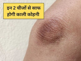 काली कोहनी पर जबरदस्त असर दिखाएंगी ये 2 चीजें, डॉक्टर ने कहा आप भी कर सकते हैं ये काम काली कोहनी पर जबरदस्त असर दिखाएंगी ये 2 चीजें, डॉक्टर ने कहा आप भी कर सकते हैं ये काम