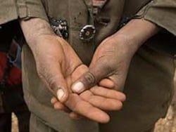 Bihar Teen Walks 150 km With Severed Arm To Escape Forced Labour