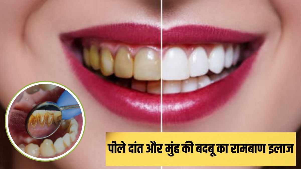 बासी मुंह चबा लें 2 पत्ते, फिर कभी नहीं होंगे पीले दांत और नहीं आएगी मुंह से बदबू