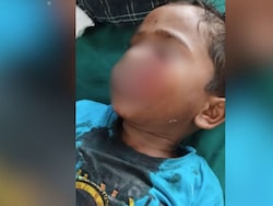 4-Year-Old Boy&#039;s Face Bitten Off By Stray Dogs In Maharashtra