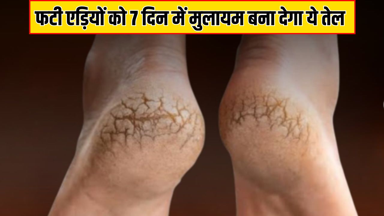 बार-बार फट जाती हैं एडी? आयुर्वेदिक न्यूट्रिशनिस्ट ने बताया तेल में मिलाकर लगा लें 4 चीजें, 7 दिन में बन जाएंगी बच्चों जैसी सॉफ्ट