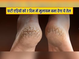बार-बार फट जाती हैं एडी? आयुर्वेदिक न्यूट्रिशनिस्ट ने बताया तेल में मिलाकर लगा लें 4 चीजें, 7 दिन में बन जाएंगी बच्चों जैसी सॉफ्ट बार-बार फट जाती हैं एडी? आयुर्वेदिक न्यूट्रिशनिस्ट ने बताया तेल में मिलाकर लगा लें 4 चीजें, 7 दिन में बन जाएंगी बच्चों जैसी सॉफ्ट