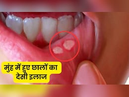मिनटों में गायब होंगे मुंह के बड़े-बड़े छाले, छुटकारा पाने के लिए आजमाएं ये घरेलू नुस्खा मिनटों में गायब होंगे मुंह के बड़े-बड़े छाले, छुटकारा पाने के लिए आजमाएं ये घरेलू नुस्खा