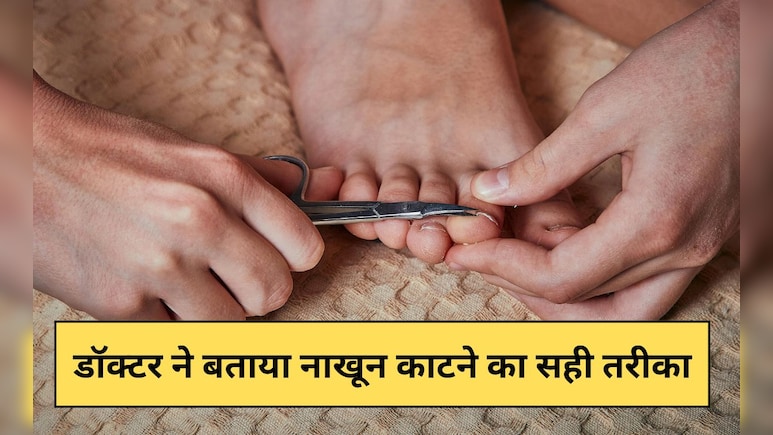 क्या आप जानते हैं नाखून काटने का सही तरीका? डॉक्टर ने बताया यह बड़ी गलती करते हैं लोग क्या आप जानते हैं नाखून काटने का सही तरीका? डॉक्टर ने बताया यह बड़ी गलती करते हैं लोग