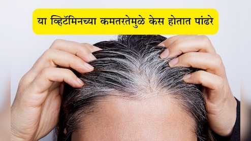 White Hair Problem: कोणत्या व्हिटॅमिनच्या कमतरतेमुळे केस पांढरे होतात? करा है नैसर्गिक उपाय