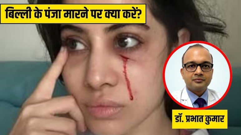 बिल्ली के पंजा मारने से Uorfi Javed के मुंह पर लगी चोट, क्या बिल्ली के नाखून से भी इंफेक्शन हो सकता है? डॉक्टर ने बताया इस कंडीशन में क्या करें