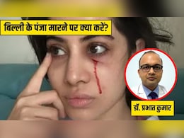 बिल्ली के पंजा मारने से Uorfi Javed के मुंह पर लगी चोट, क्या बिल्ली के नाखून से भी इंफेक्शन हो सकता है? डॉक्टर ने बताया इस कंडीशन में क्या करें बिल्ली के पंजा मारने से Uorfi Javed के मुंह पर लगी चोट, क्या बिल्ली के नाखून से भी इंफेक्शन हो सकता है? डॉक्टर ने बताया इस कंडीशन में क्या करें