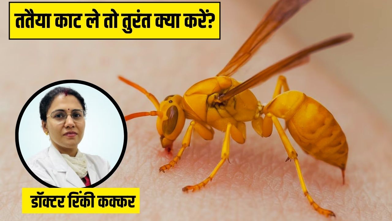 पीली ततैया काट ले तो क्या करें? डॉक्टर ने बताया सूजन को तुरंत कम करने का तरीका, नहीं चढ़ेगा जहर