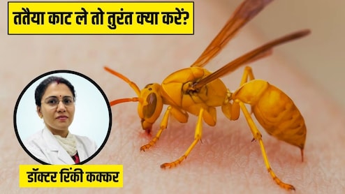 पीली ततैया काट ले तो क्या करें? डॉक्टर ने बताया सूजन को तुरंत कम करने का तरीका, नहीं चढ़ेगा जहर
