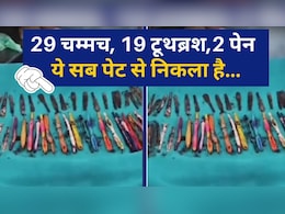 आदमी के पेट से निकले 29 चम्मच, 19 टूथब्रश और 2 पेन, इस अजीब बीमारी के चलते खाता था ये सब आदमी के पेट से निकले 29 चम्मच, 19 टूथब्रश और 2 पेन, इस अजीब बीमारी के चलते खाता था ये सब