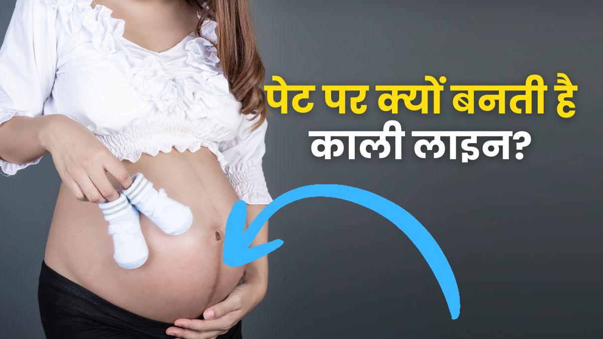 प्रेग्नेंसी में पेट पर क्यों बनती है काली लंबी लाइन, क्या इससे घबराने की जरूरत है?