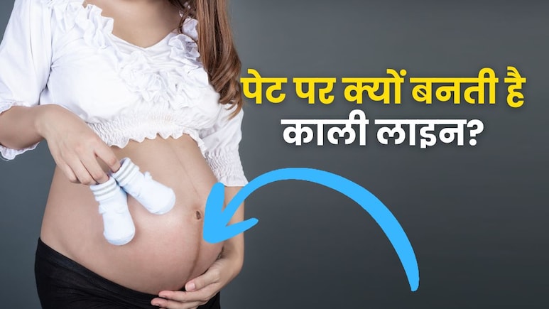 प्रेग्नेंसी में पेट पर क्यों बनती है काली लंबी लाइन, क्या इससे घबराने की जरूरत है? प्रेग्नेंसी में पेट पर क्यों बनती है काली लंबी लाइन, क्या इससे घबराने की जरूरत है?