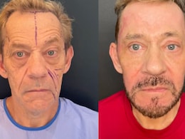 61-Year-Old Man's Incredible 43 Kg Weight Loss Proves It's Never Too Late